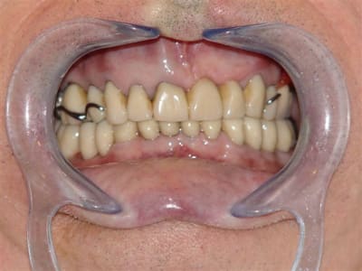 Fin cas global kioqmq - Eugenol