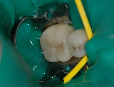 Fin fur95d - Eugenol