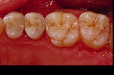 Final u34ccv - Eugenol