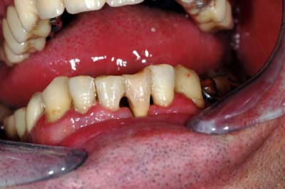 Fini01 ycdqu8 - Eugenol