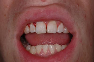 Fini fsnvrd - Eugenol