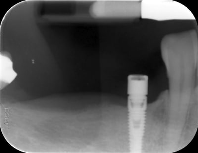 Fmaxzwwzof939eerc526fz2uj718 - Eugenol