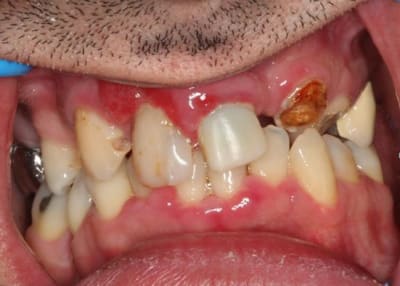 Front thskjs - Eugenol