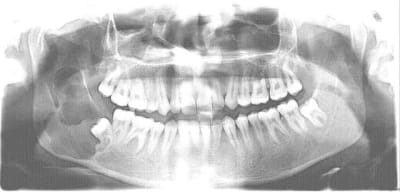Fur hfbslf - Eugenol