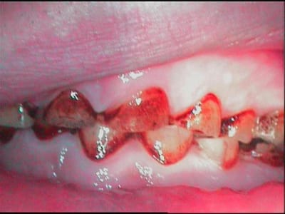 Gauche dkiwet - Eugenol