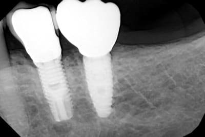 Gdagdbpmzexnq3i5zu92t9eh7s1o - Eugenol