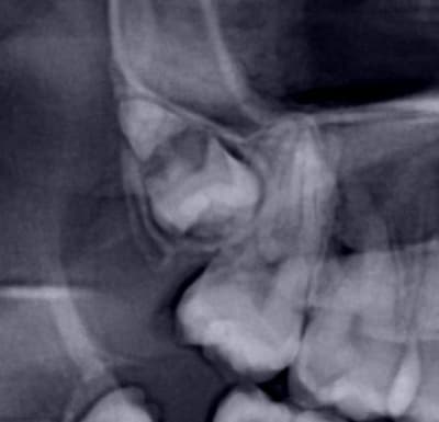 Grossissement vqkmkn - Eugenol