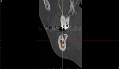 Gui m f cross section38 zueqqq - Eugenol