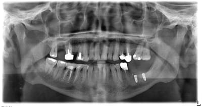 Gxvgrabckfzcx1maxqfa - Eugenol