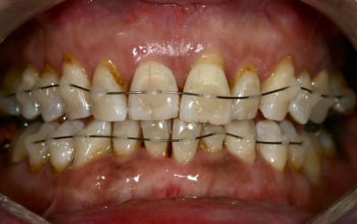 Haut et bas  large  i3w2ix - Eugenol