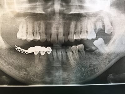 Hdkhax1ptwvp8j6elnng - Eugenol