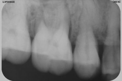 Hmed1 u9guun - Eugenol