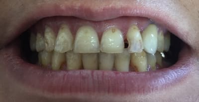 Image nvsmmt - Eugenol