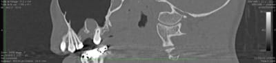 Image suspecte 1 - Eugenol