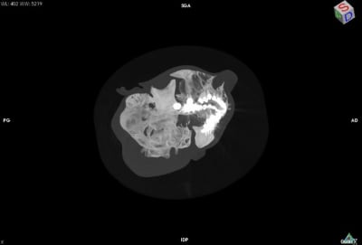 Image suspecte 3 miyabj - Eugenol