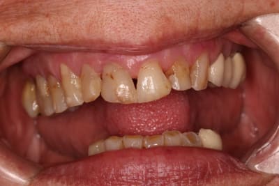 Img1 s0wljt - Eugenol