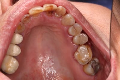 Img3 paoaxe - Eugenol