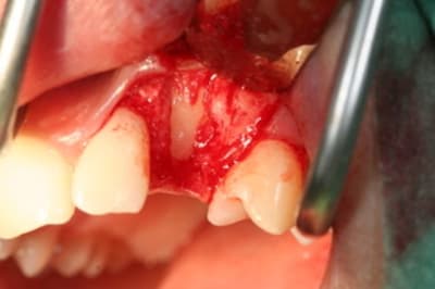 Img 0335 hgqxv1 - Eugenol