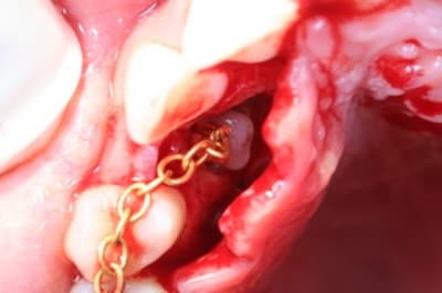 Img 0347 bs9vbj - Eugenol