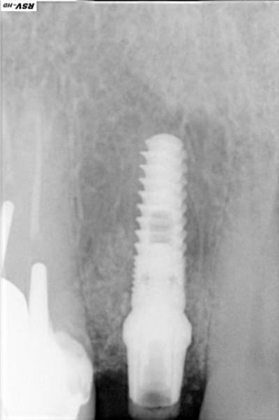 Imp dvdwmr - Eugenol