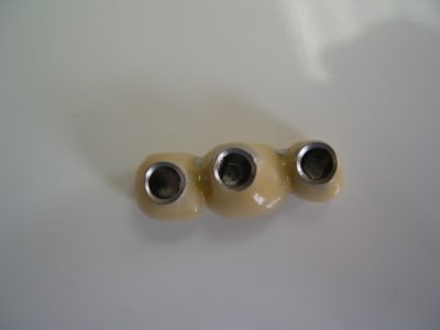 Implants 004 gci7pr - Eugenol