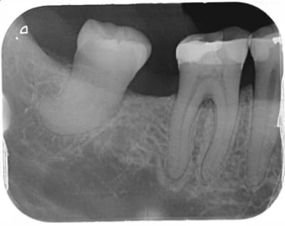 Inf4 zeve78 - Eugenol