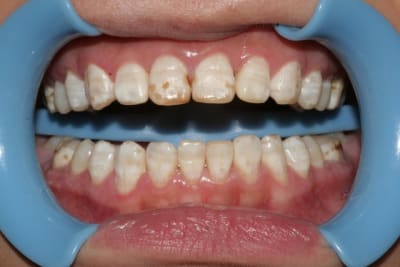 Initial1 og5vdh - Eugenol