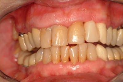 Initial bblioo - Eugenol