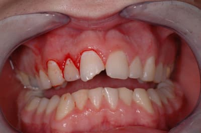 Initial c8s4vp - Eugenol