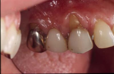 Initial vjovht - Eugenol