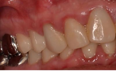 Integration emax xhvn7m - Eugenol