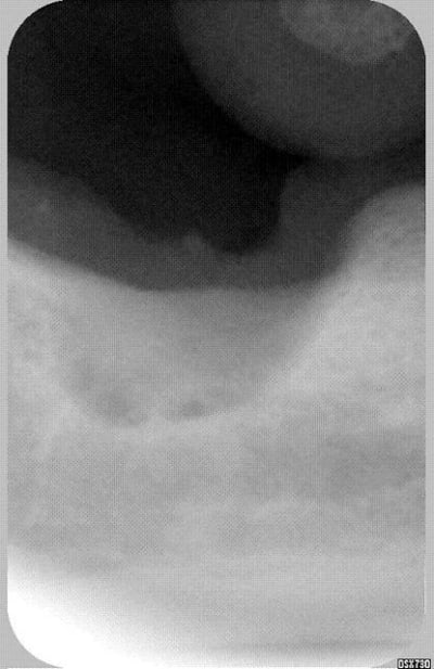 Itou m0p00m - Eugenol