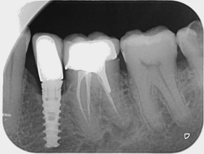 Ivftrp2kshkam06zz5n3 - Eugenol