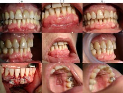 J0 j15 j21 x5fidd - Eugenol