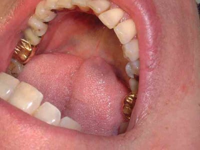 Jau1 hcusai - Eugenol