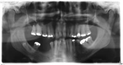 Je cale w8cqnp - Eugenol