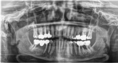 Jqx5bdzbqeukqplqmdod - Eugenol