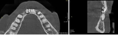 Jud24ht82tzi5y7rp7mzaepngzsz - Eugenol