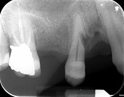 Jvba0aka7lztgagftqz9 - Eugenol