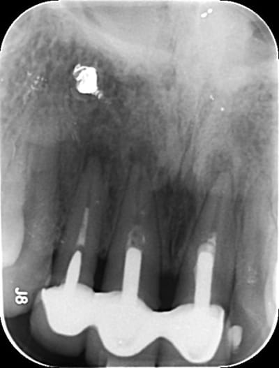 Kiki jiikhu - Eugenol