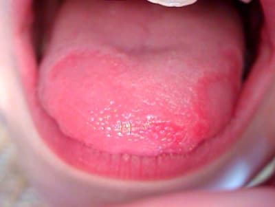 Langue wscqez - Eugenol