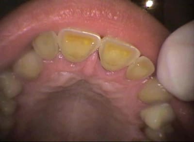 Lar3 gbxpdg - Eugenol