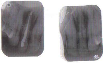 Lastscan numérisés uwmfqt - Eugenol