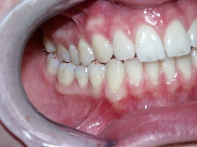 Latéralitédroite ye7nyx - Eugenol