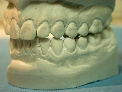 Latgauche1 yirlwq - Eugenol