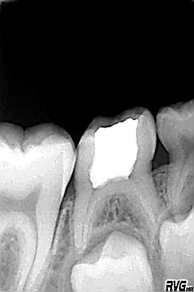 Laura 07 co0t4o - Eugenol