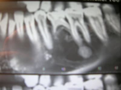 Lb8yiwwn7lqhvoa0tpsk - Eugenol