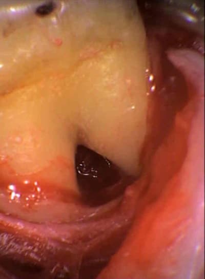 Les inter 3 xbzzit - Eugenol