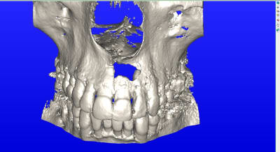Lievoux bruno aperçu1 lznqcc - Eugenol