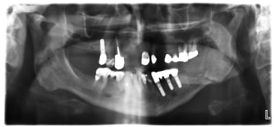 Lioa5b9r8yamcpj8gxku - Eugenol